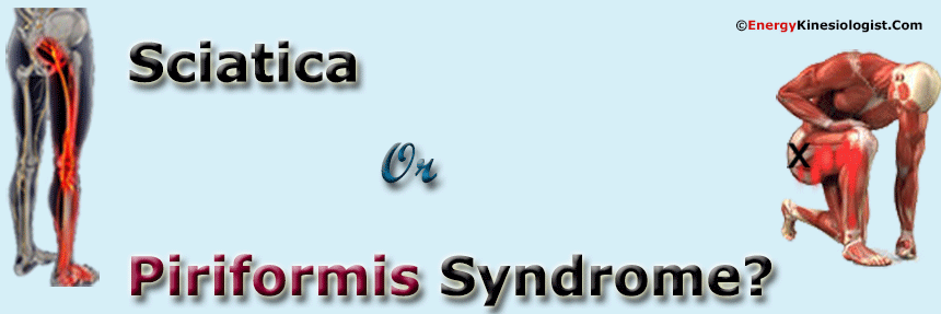 Piriformis Syndrome and Sciatica Pain – Caring Medical Florida